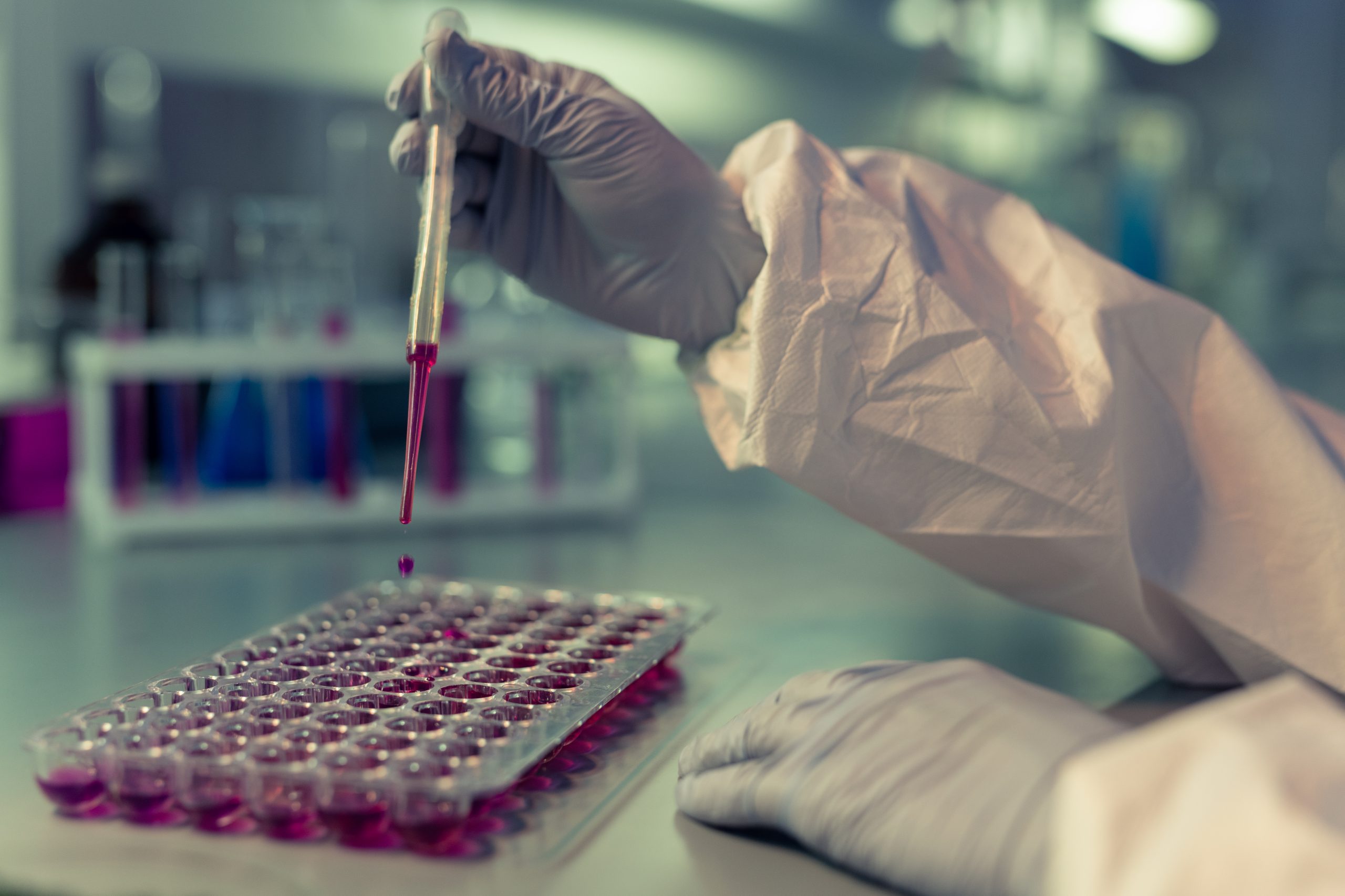 Beneficios del Lector de Microplaca para la detección de la Hepatitis B